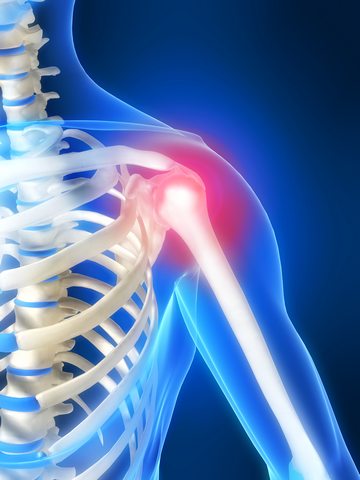 ramenski zglob. liječenje boli u ramenima